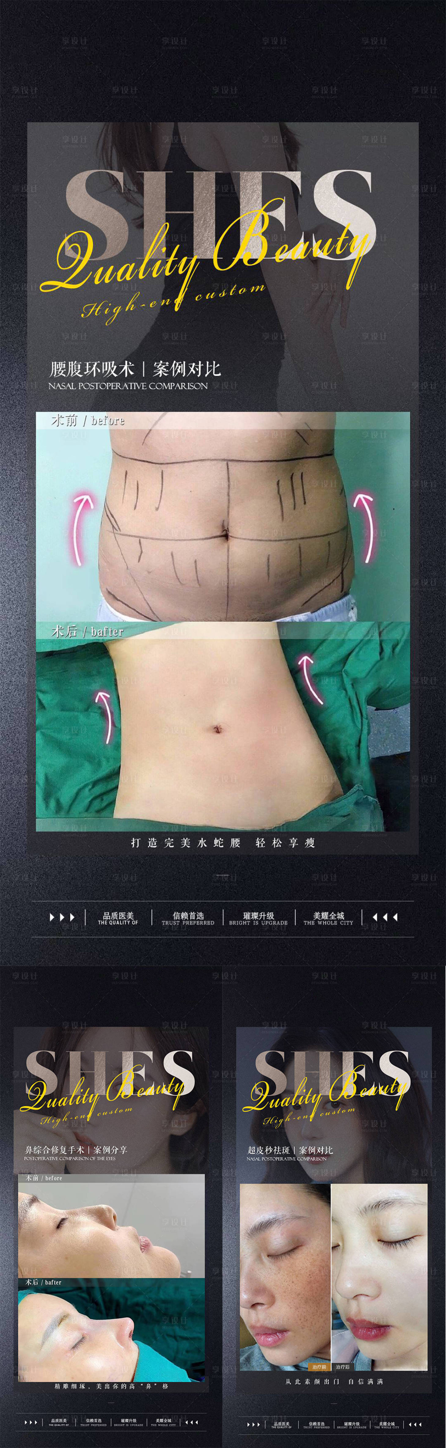 源文件下载【医美案例对比系列海报】编号：26960012558429529