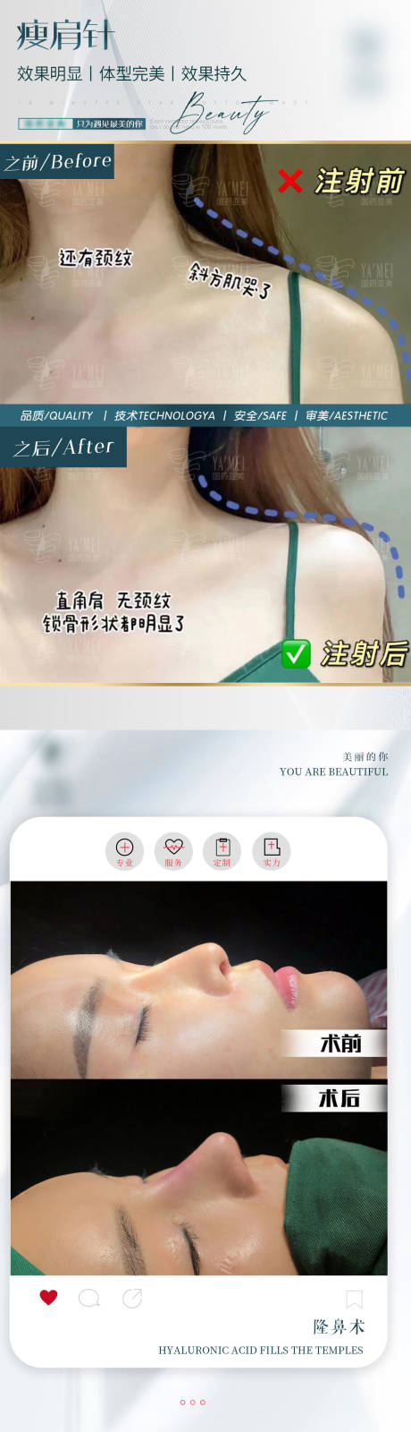 源文件下载【案例对比图】编号：55590012803763029