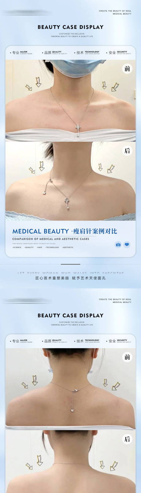 源文件下载【医美案例海报】编号：97730012962798045