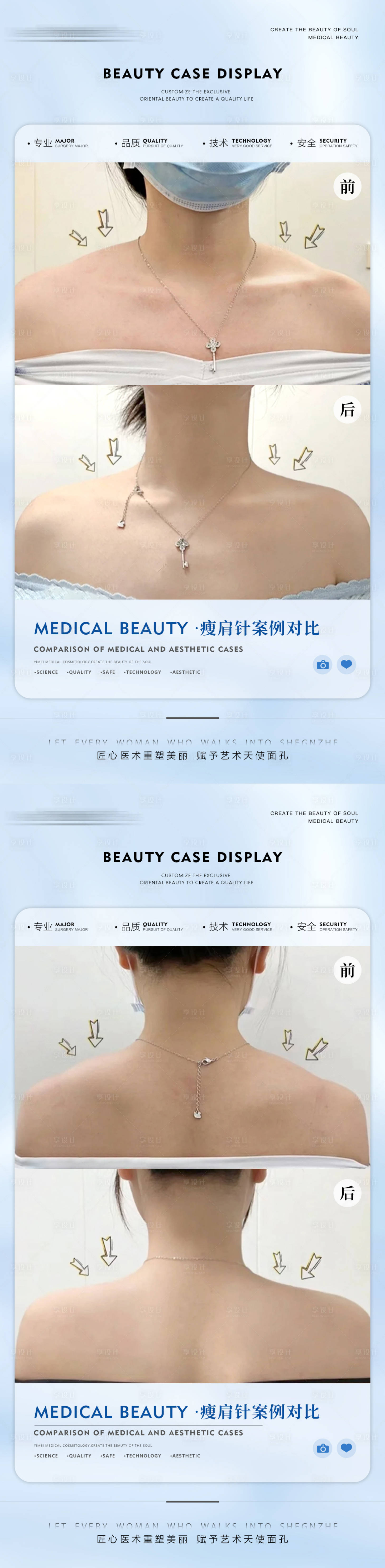 源文件下載【享設計】搜索編號：97730012962798045【醫美案例海報】