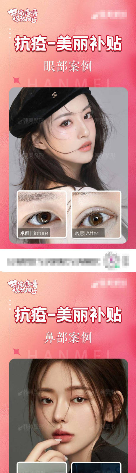 源文件下載【醫美整形案眼部鼻部胸部例對比海報】編號：31820009786257606