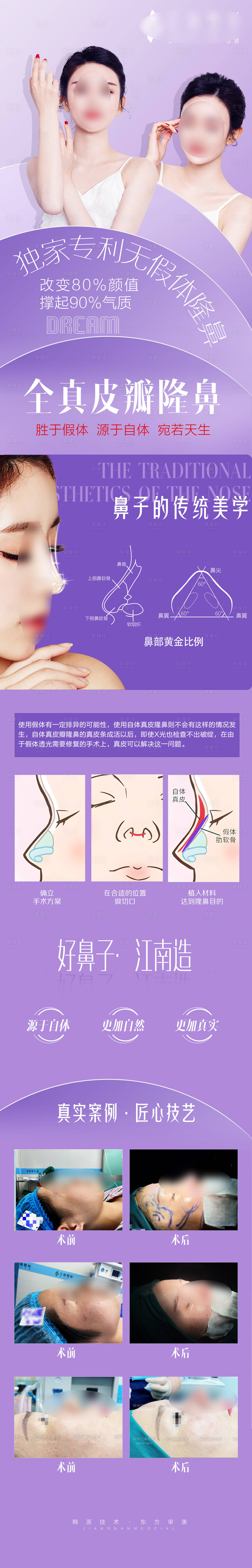 源文件下載【享設(shè)計(jì)】搜索編號(hào)：91360012855181719【醫(yī)美隆鼻鼻綜合長(zhǎng)圖】