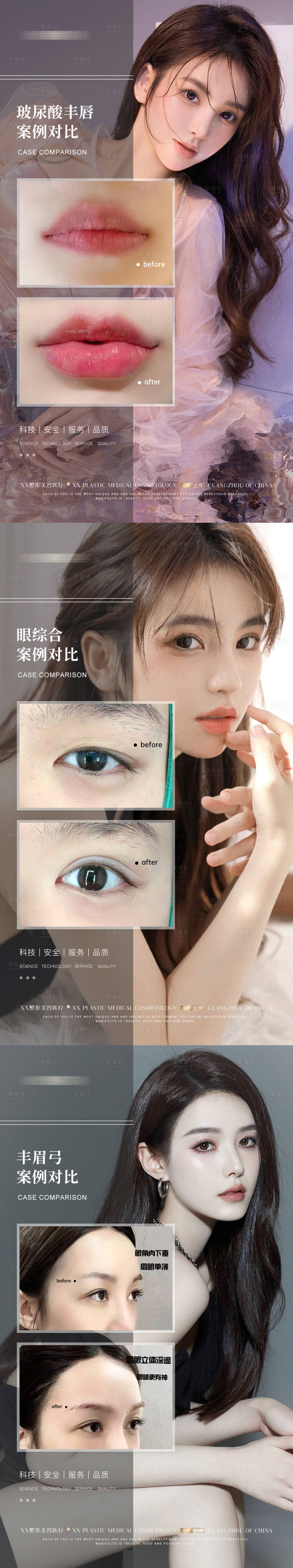 源文件下載【醫(yī)美案例海報(bào)】編號(hào)：60710013039024038