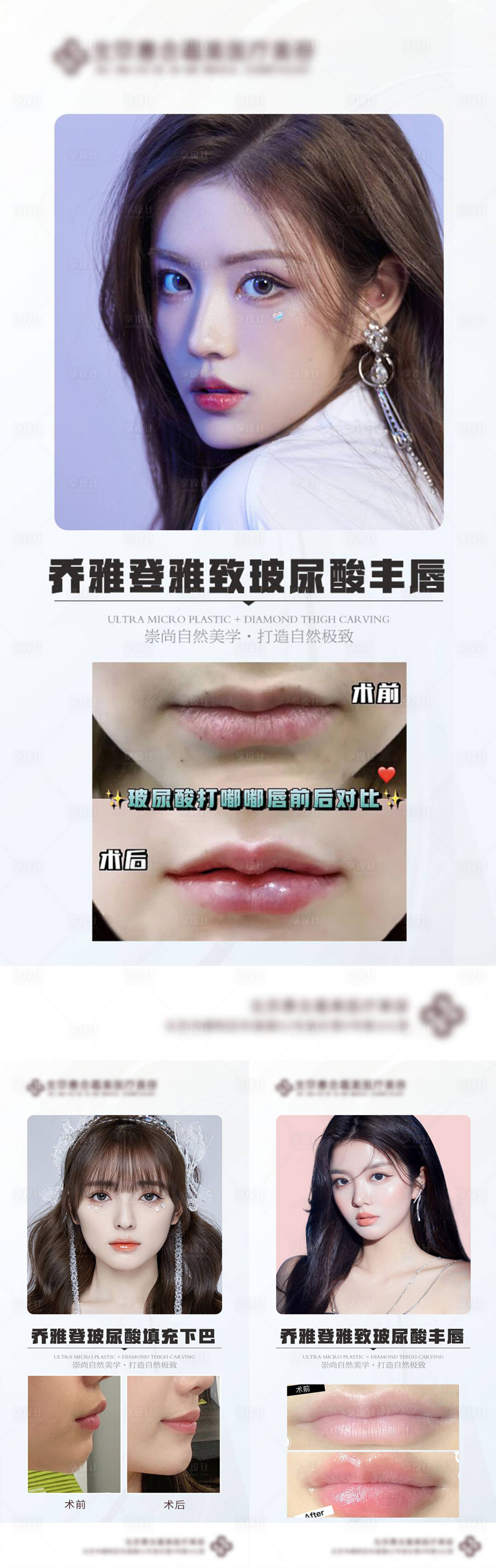 源文件下载【医美案例对比】编号：27150012560612578
