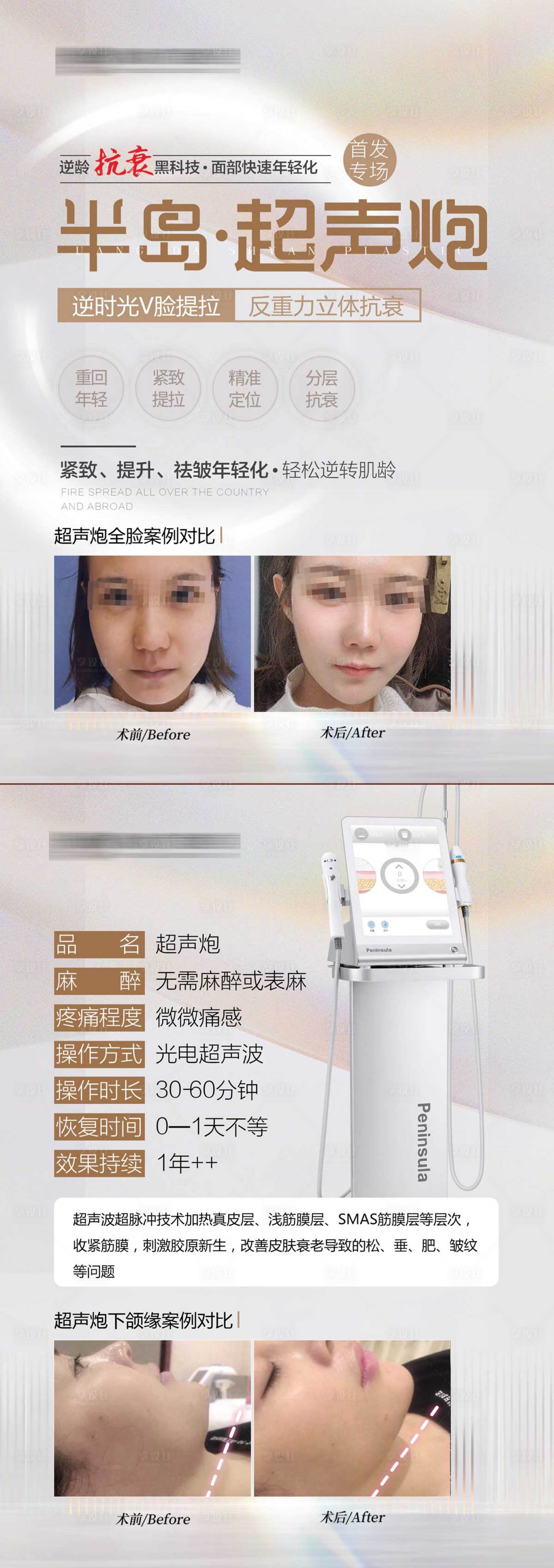 源文件下载【超声炮宣传单张】编号：47350012522108562