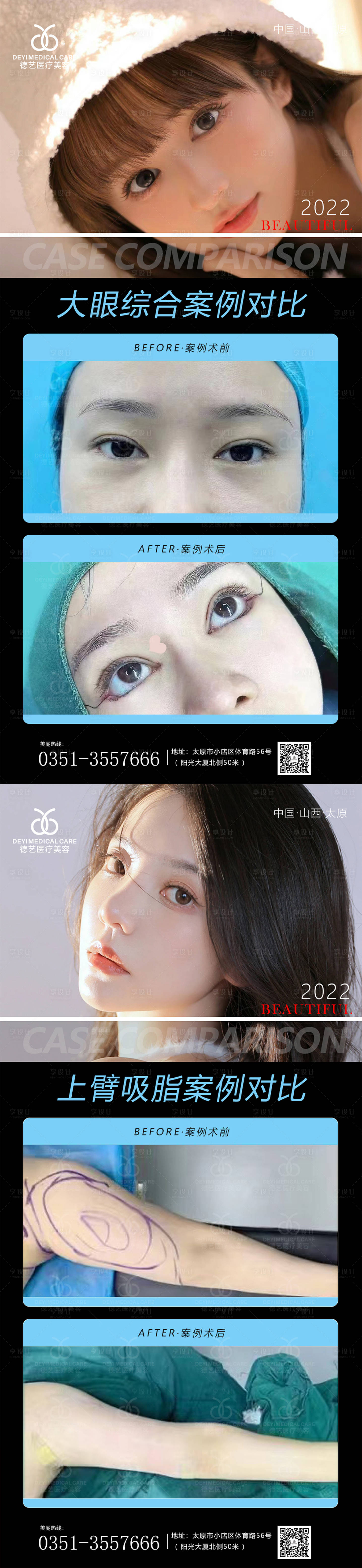 源文件下載【享設計】搜索編號：92160012933154842【醫美案例對比圖系列海報】