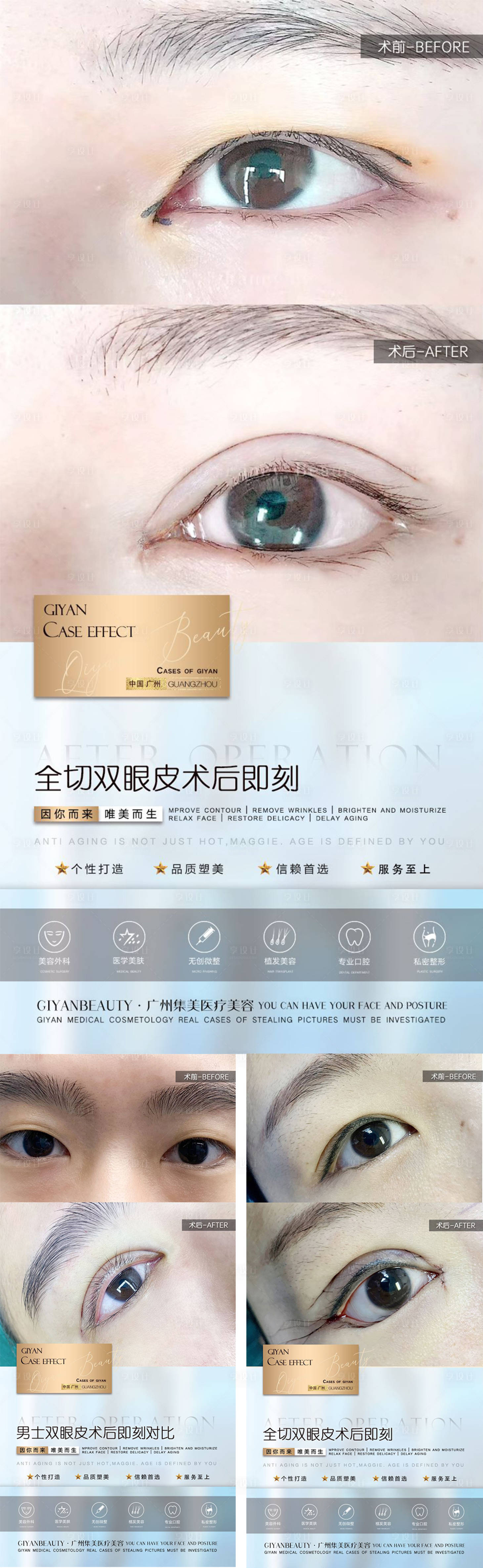 源文件下载【享设计】搜索编号：23420012558614921【医美案例对比系列海报】