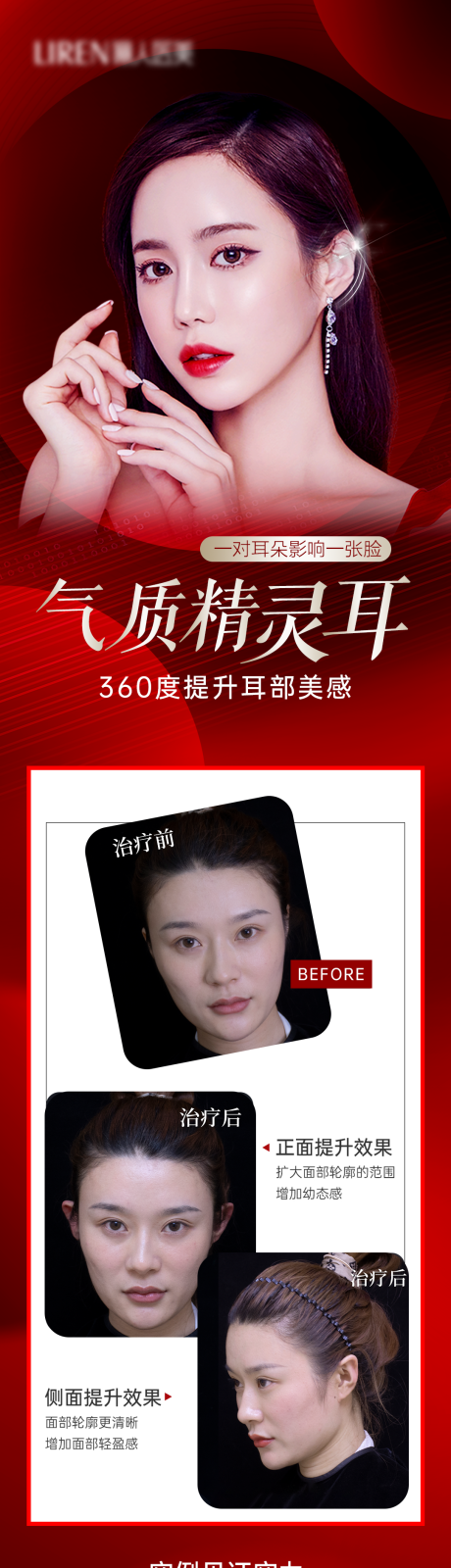 源文件下载【医美活动气质精灵耳长图】编号：31490012569531295