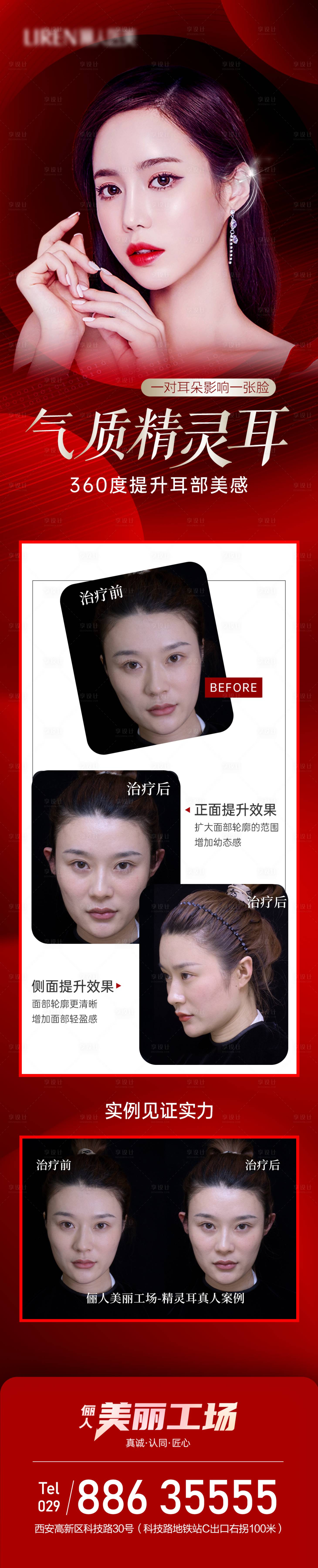 源文件下载【享设计】搜索编号：31490012569531295【医美活动气质精灵耳长图】