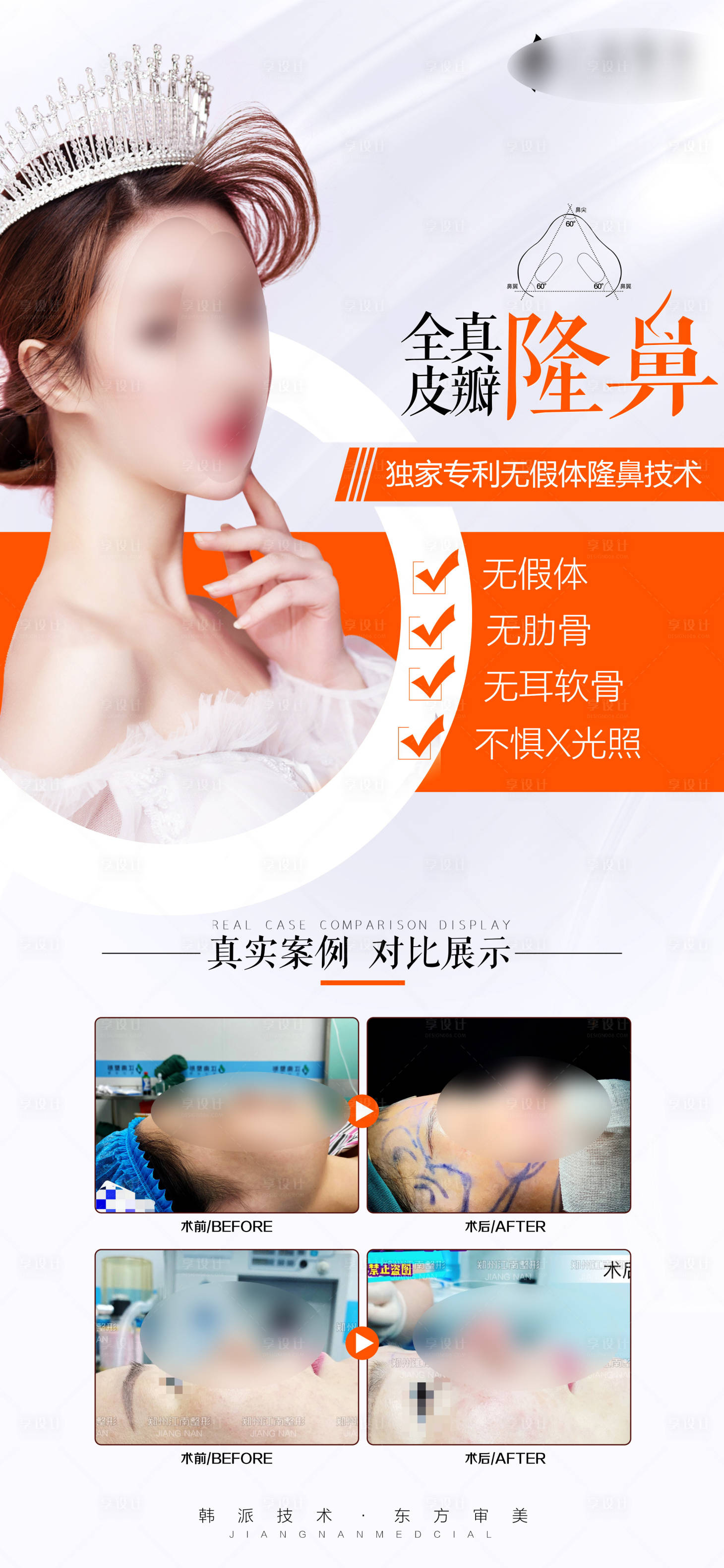 源文件下載【享設(shè)計(jì)】搜索編號(hào)：17780012855076146【醫(yī)美高端雙隆鼻鼻綜合海報(bào)長圖】