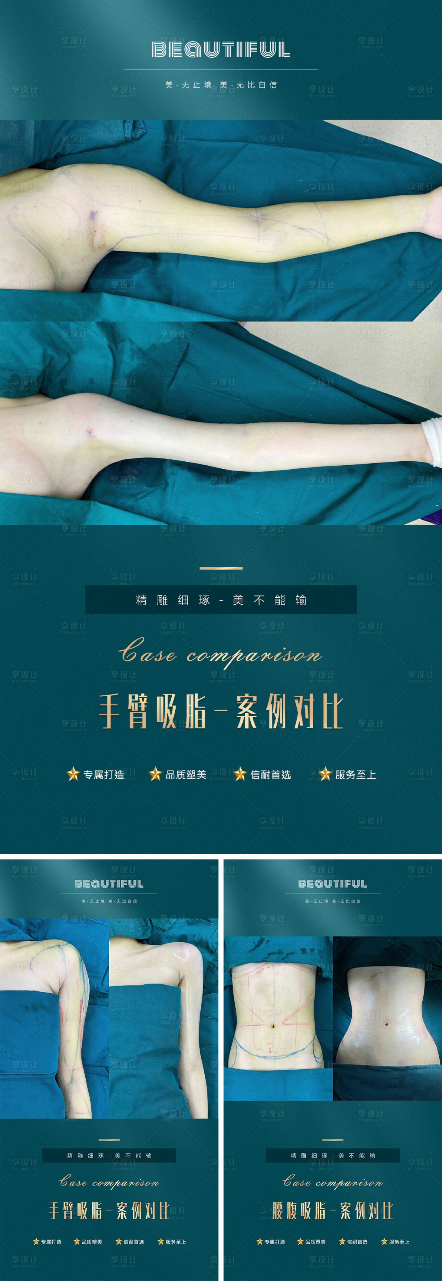 源文件下载【享设计】搜索编号：54290012877296993【医美案例对比系列海报】