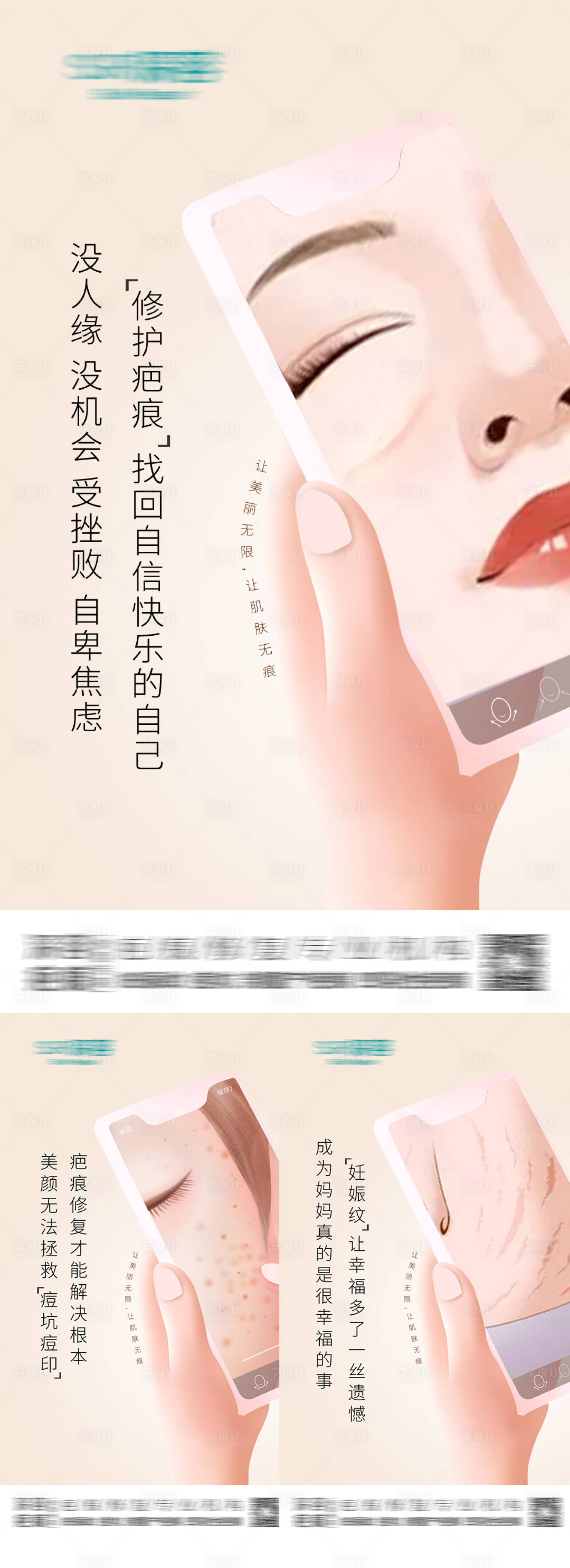 源文件下載【享設(shè)計(jì)】搜索編號(hào)：57760012837142715【醫(yī)美疤痕修復(fù)卡通組圖】
