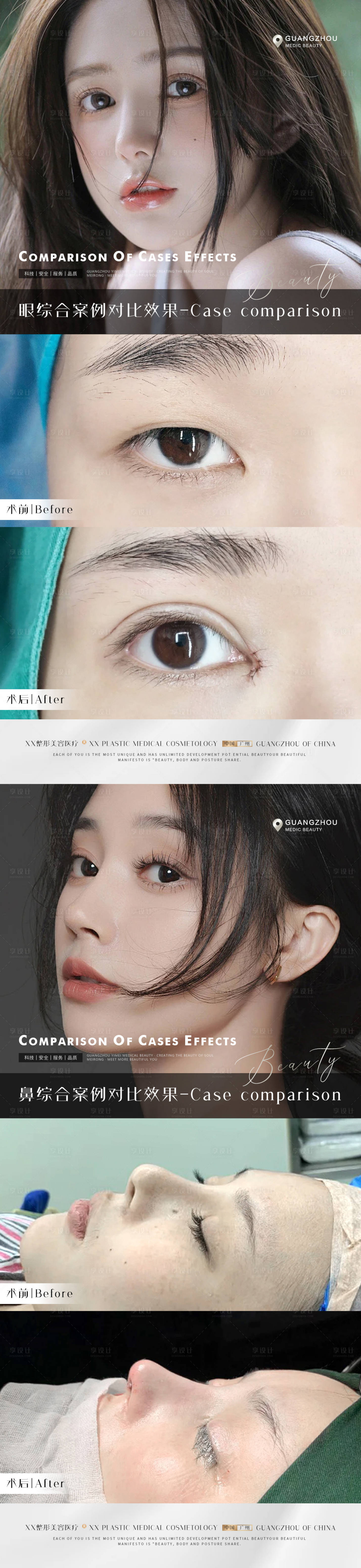 源文件下载【医美案例美眼海报】编号：65080012990005196