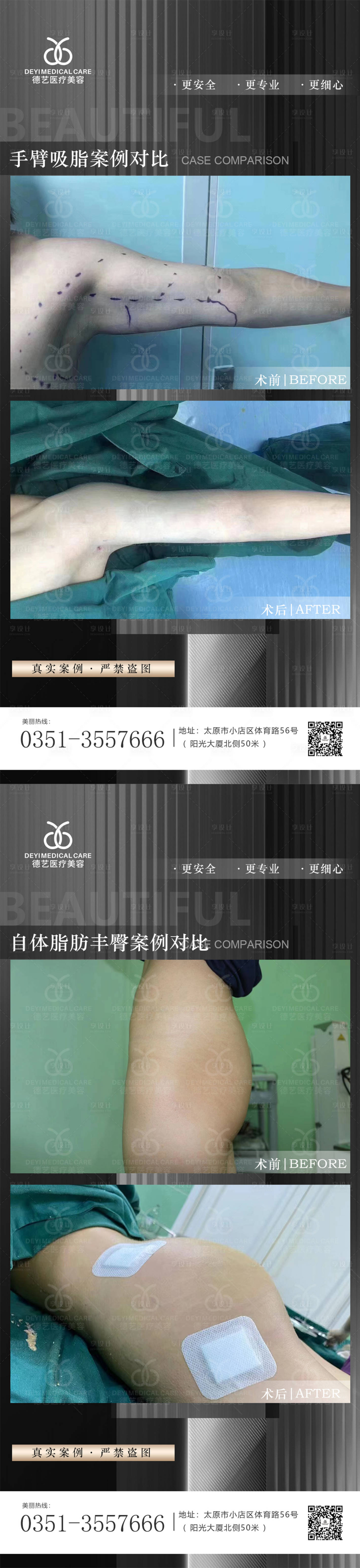 源文件下载【享设计】搜索编号：39630012512491991【医美案例对比图系列海报】