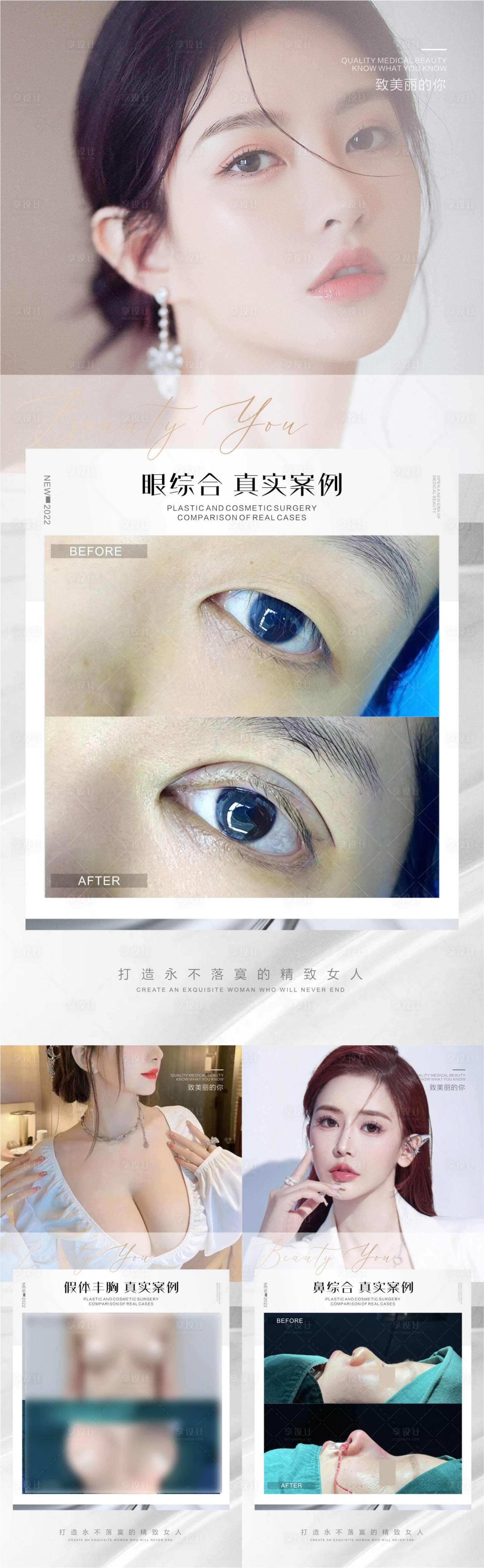 源文件下载【眼综合鼻综合假体丰胸医美整形案例海报】编号：65390012696084197