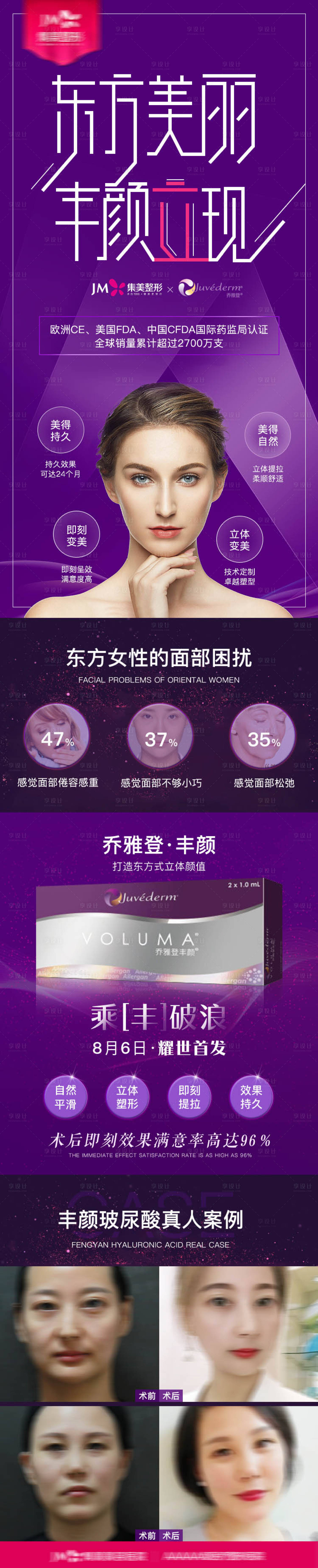 源文件下載【醫美喬雅登新品發布】編號：34600012614098498