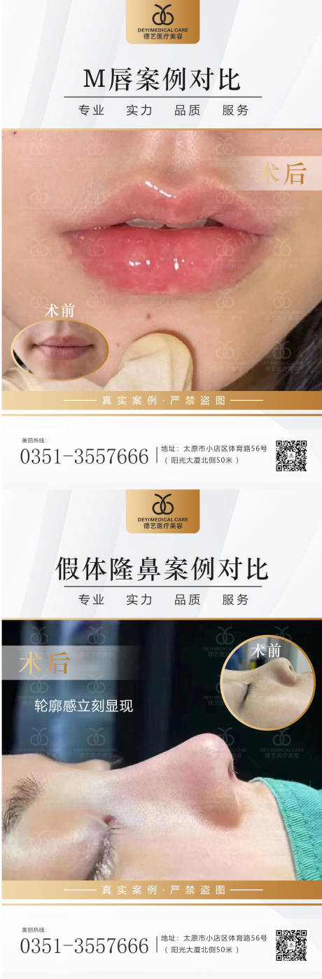 源文件下载【医美案例对比图系列海报】编号：24640013022995473