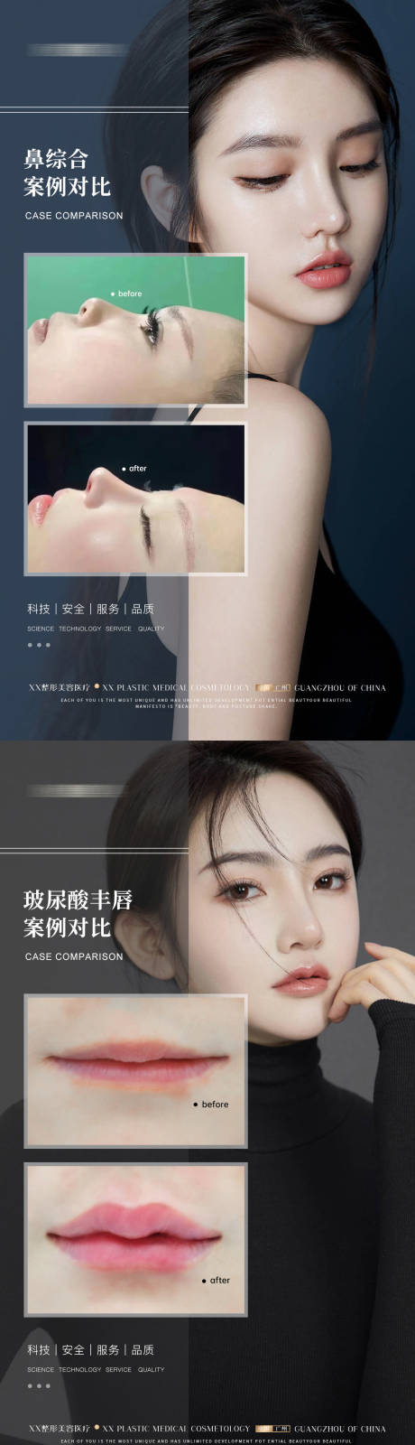 源文件下载【医美案例系列海报】编号：92540013038958933
