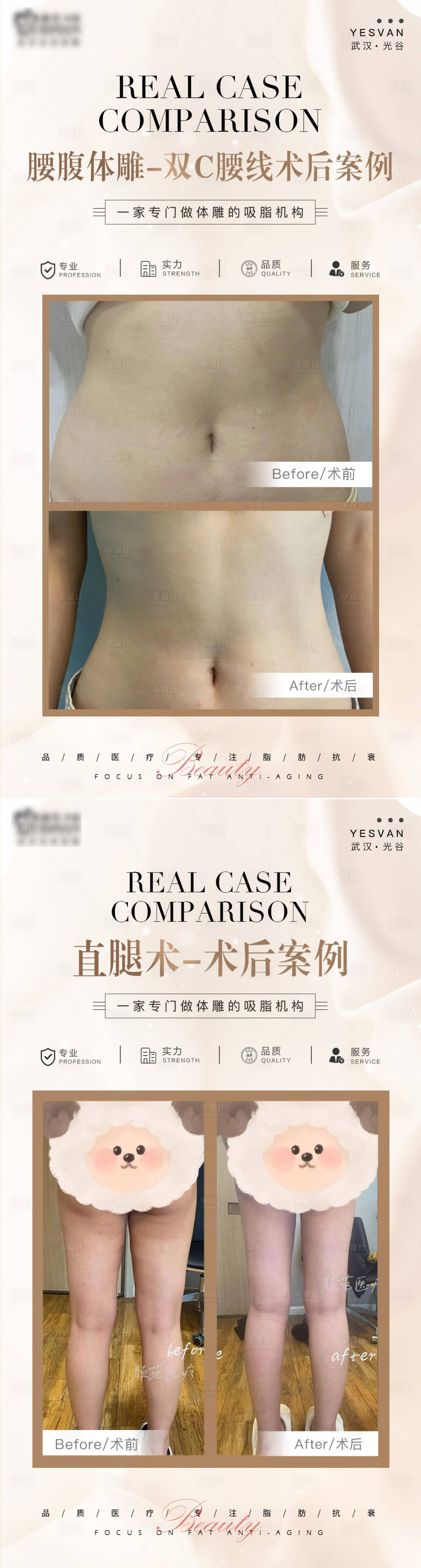源文件下载【医美对比图案例海报】编号：44600012815162056