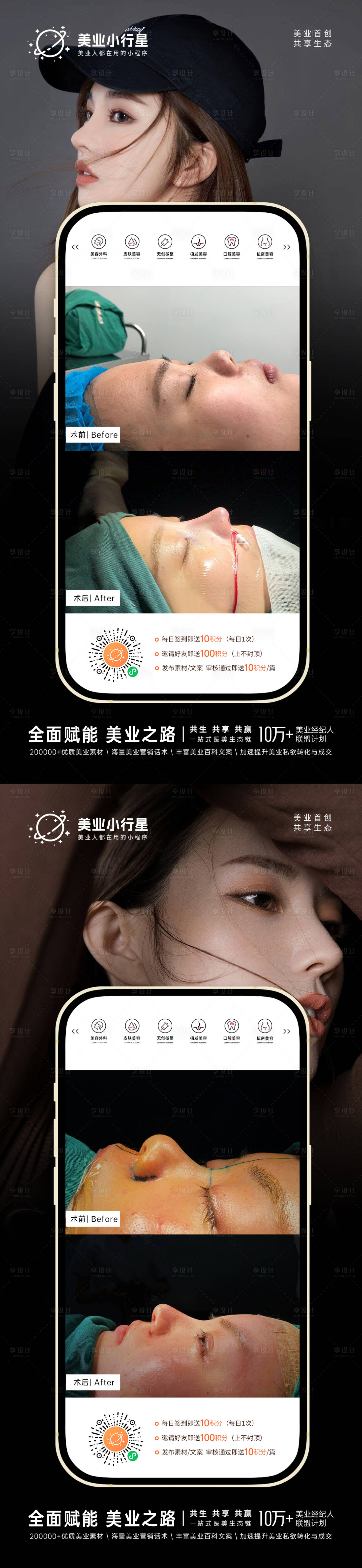 源文件下載【享設(shè)計(jì)】搜索編號(hào)：20500013284936212【醫(yī)美整形美容真人案例分享集】