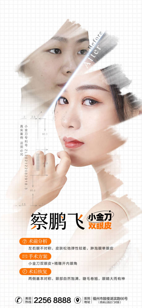 源文件下载【享设计】搜索编号：91670013410609675【医美双眼皮案例海报】