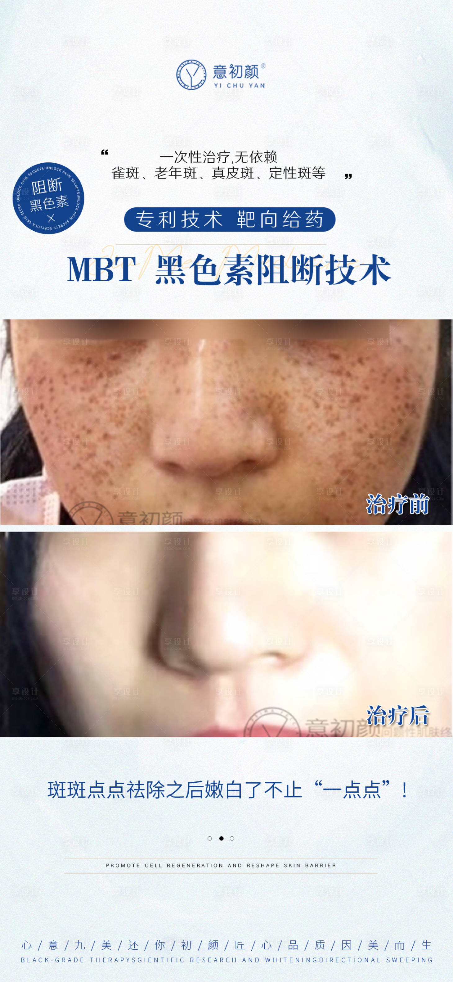 源文件下载【享设计】搜索编号：67600013423241580【长沙医美护肤祛斑对比效果产品图美美妆】
