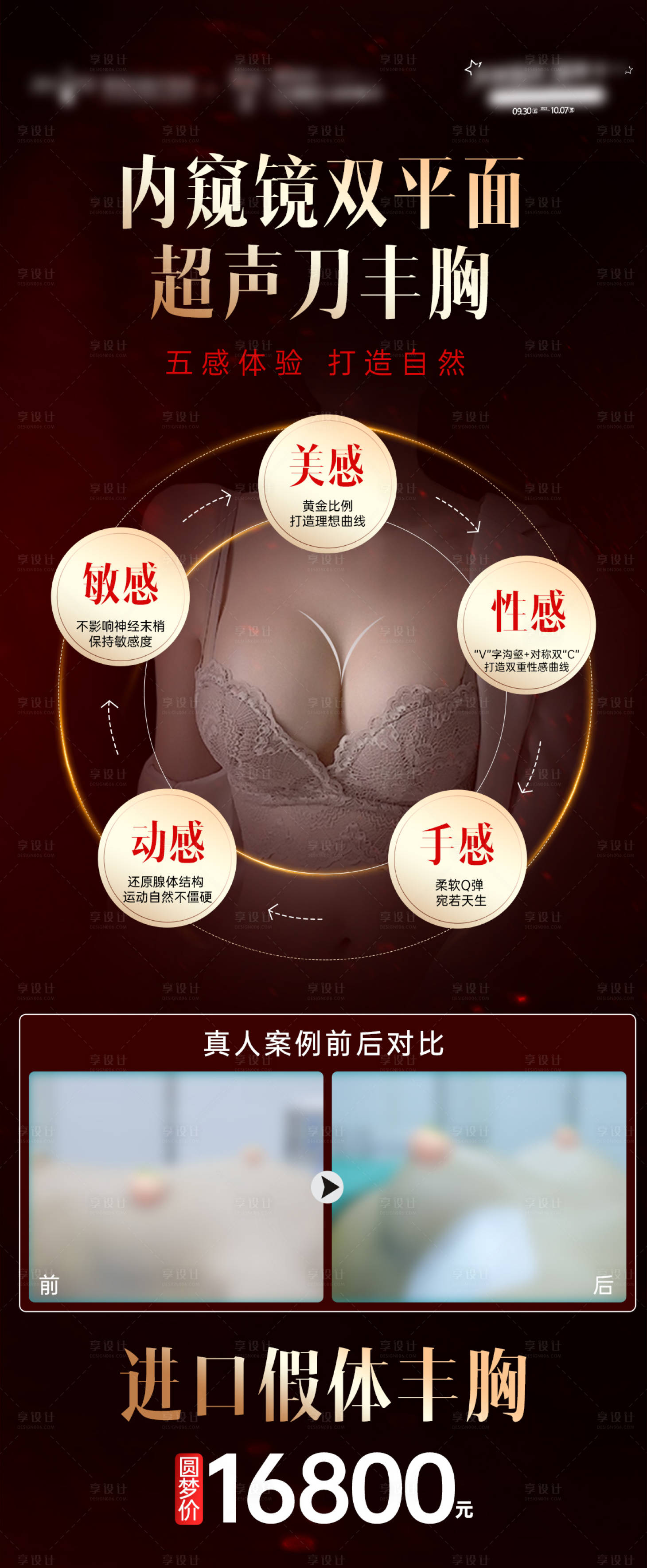 源文件下载【内窥镜双平面超声刀隆胸海报】编号：35610013484304570