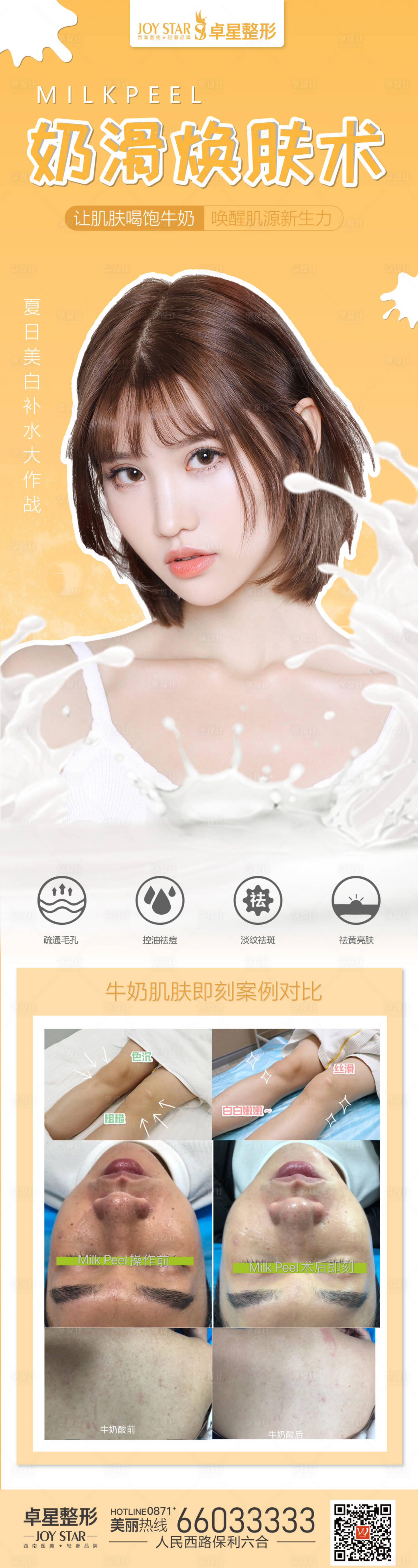 源文件下载【美白牛奶肌刷酸朋友圈海报】编号：91180013105232643