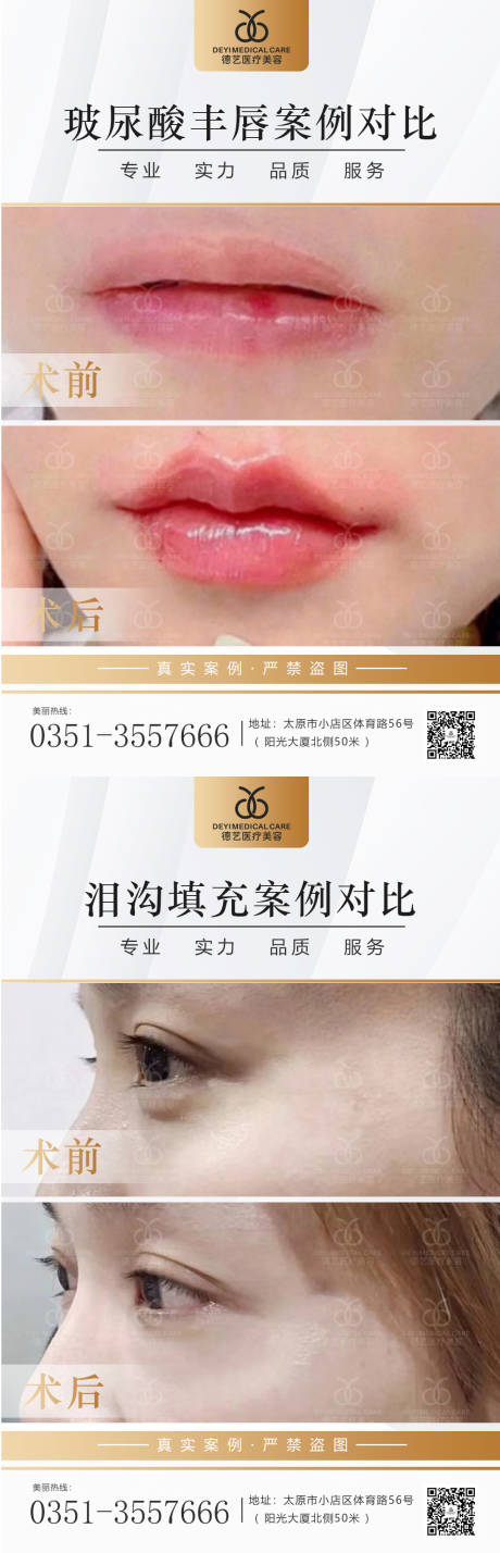 源文件下载【医美案例对比图】编号：34220013378938635