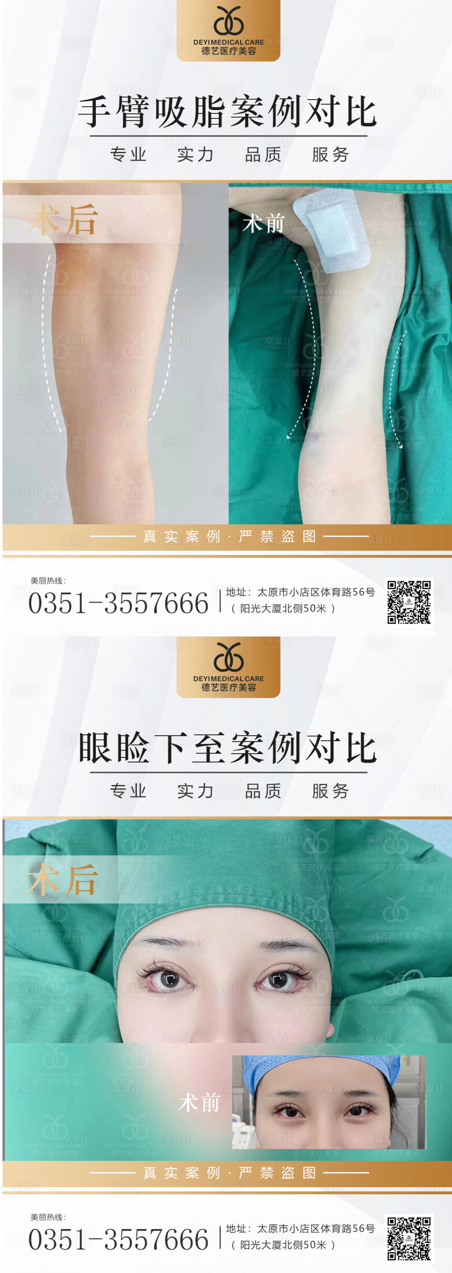 源文件下载【医美案例对比图】编号：52510013159316611