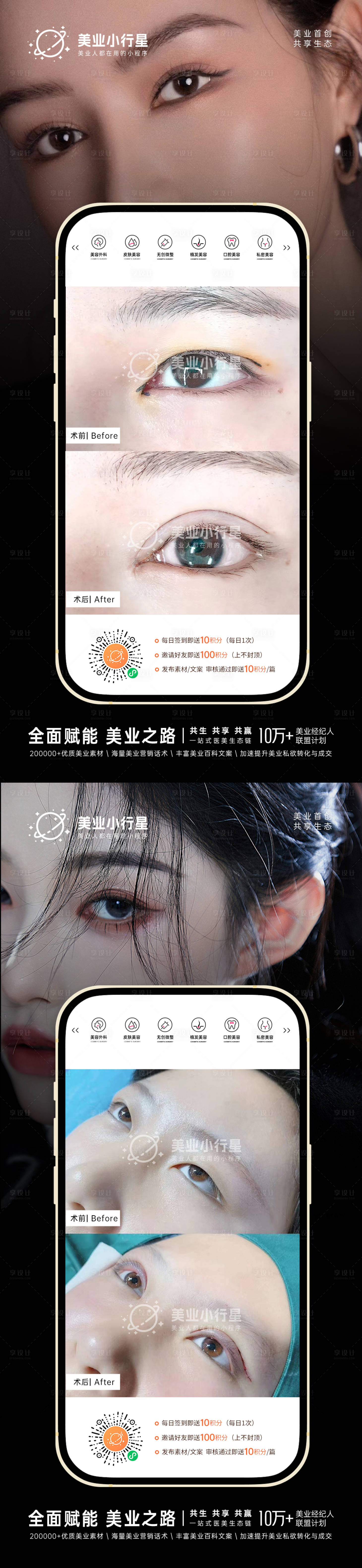 源文件下载【医美整形美容真人案例分享海报】编号：88190013457937011