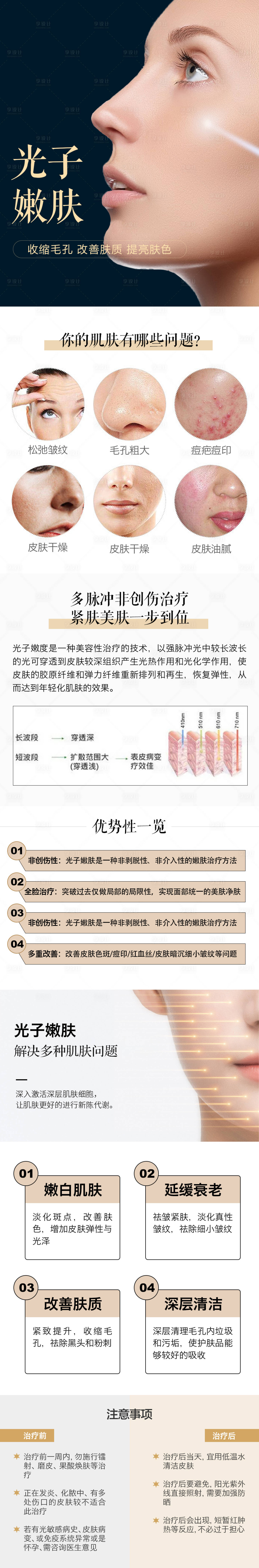 源文件下载【光子嫩肤详情页】编号：20221125161234135