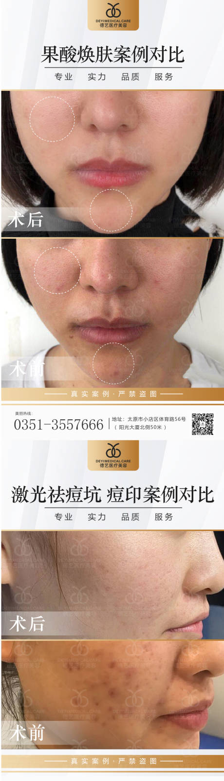 源文件下載【醫美案例對比圖系列海報】編號：50390013159251926