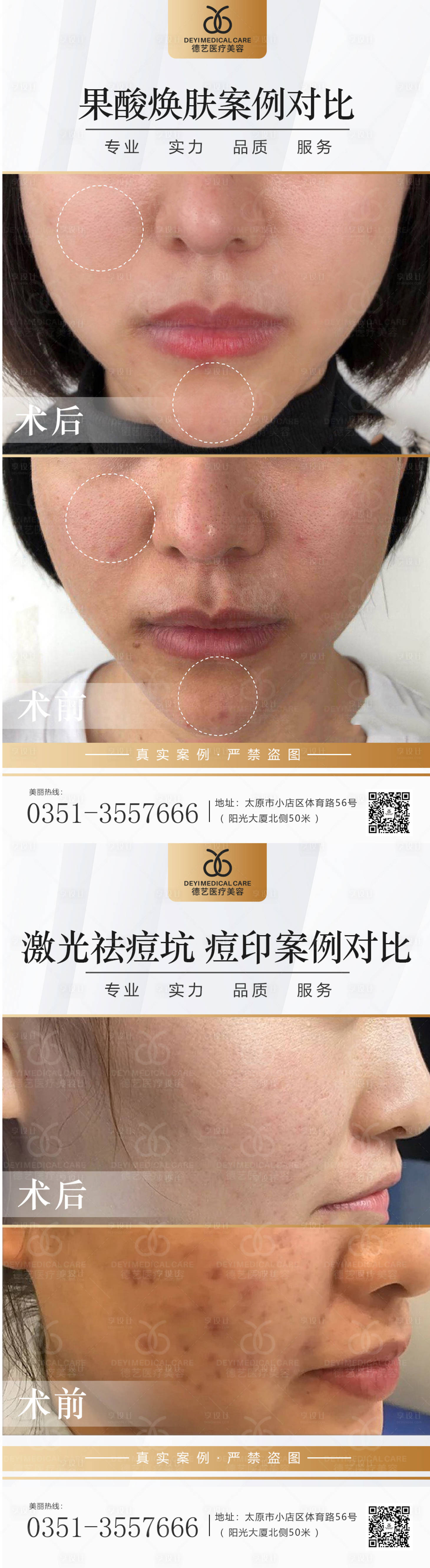 源文件下载【享设计】搜索编号：50390013159251926【医美案例对比图系列海报】