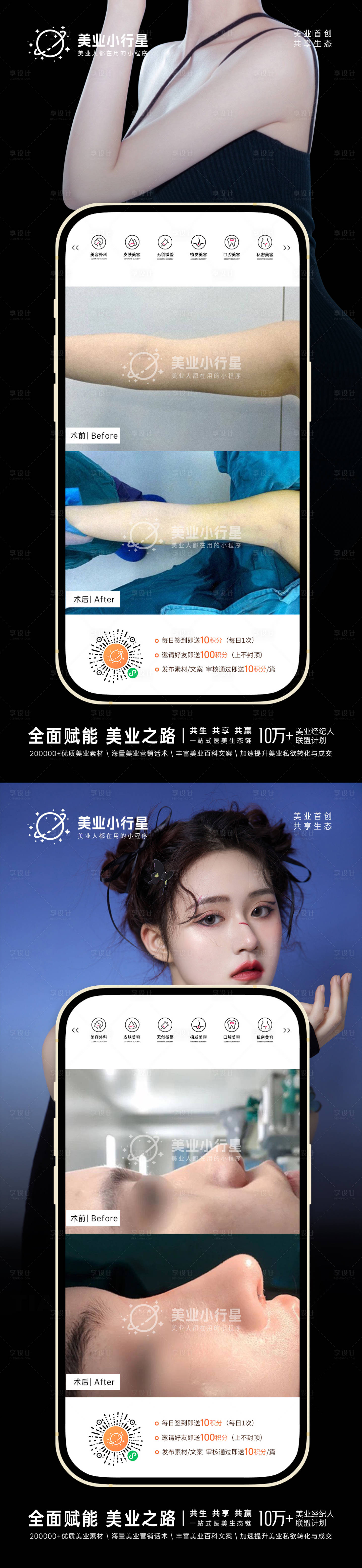 源文件下載【享設計】搜索編號：72310013441317806【醫美整形美容真人案例分享集系列海報】