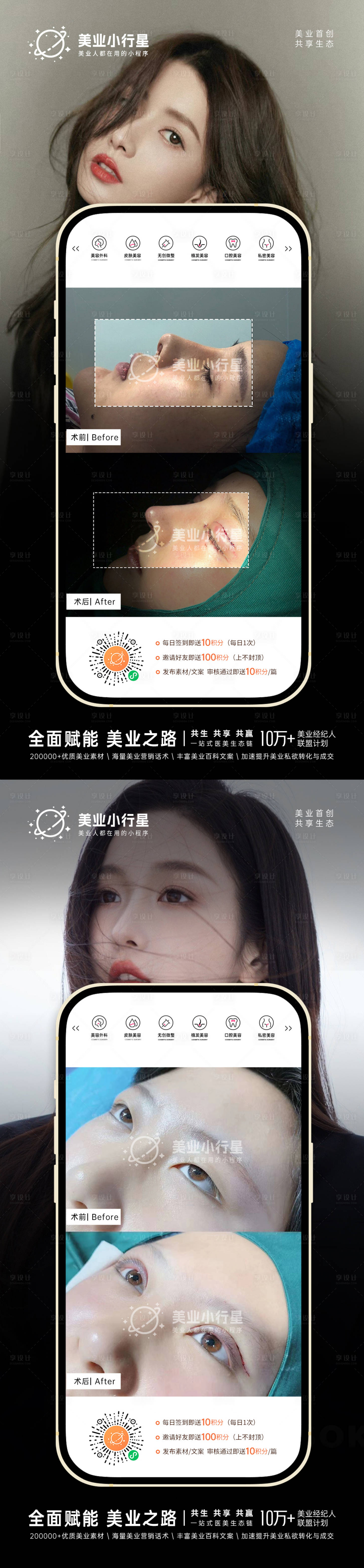 源文件下載【享設計】搜索編號：44260013290628339【醫美整形美容真人案例分享集】