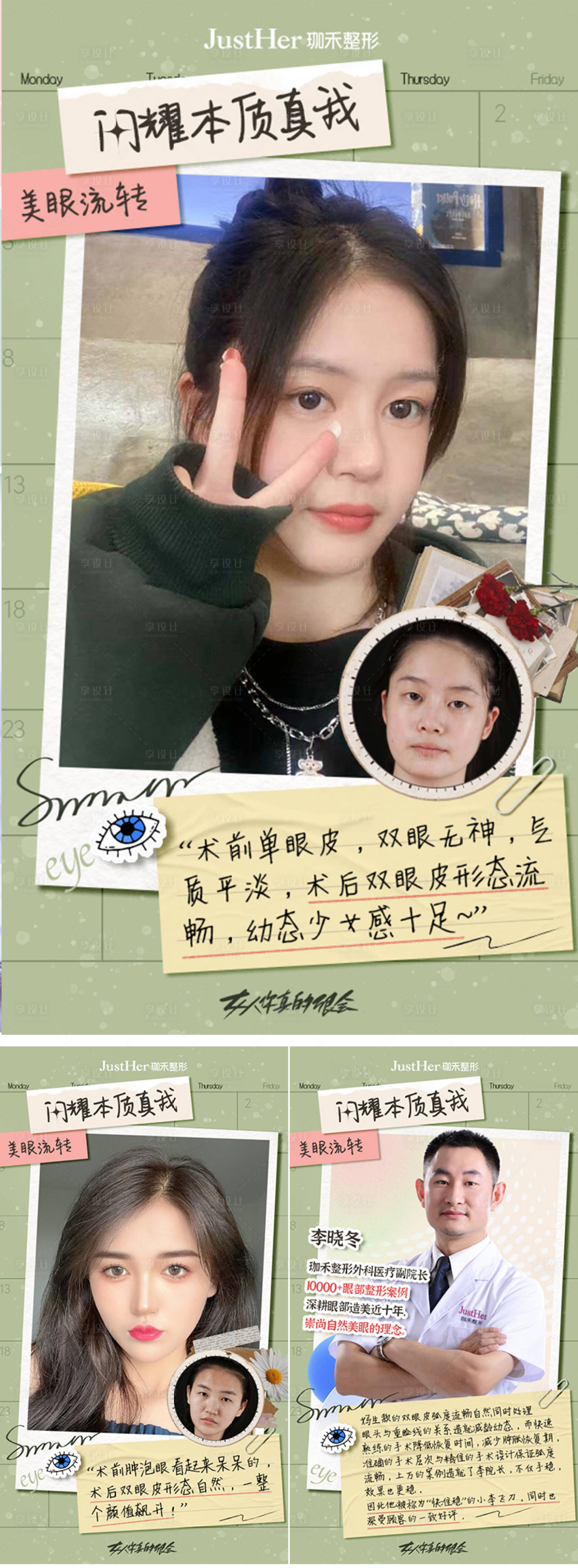 源文件下載【享設(shè)計(jì)】搜索編號(hào)：13030013622322948【醫(yī)美幼態(tài)眼朋友圈案例系列海報(bào)】