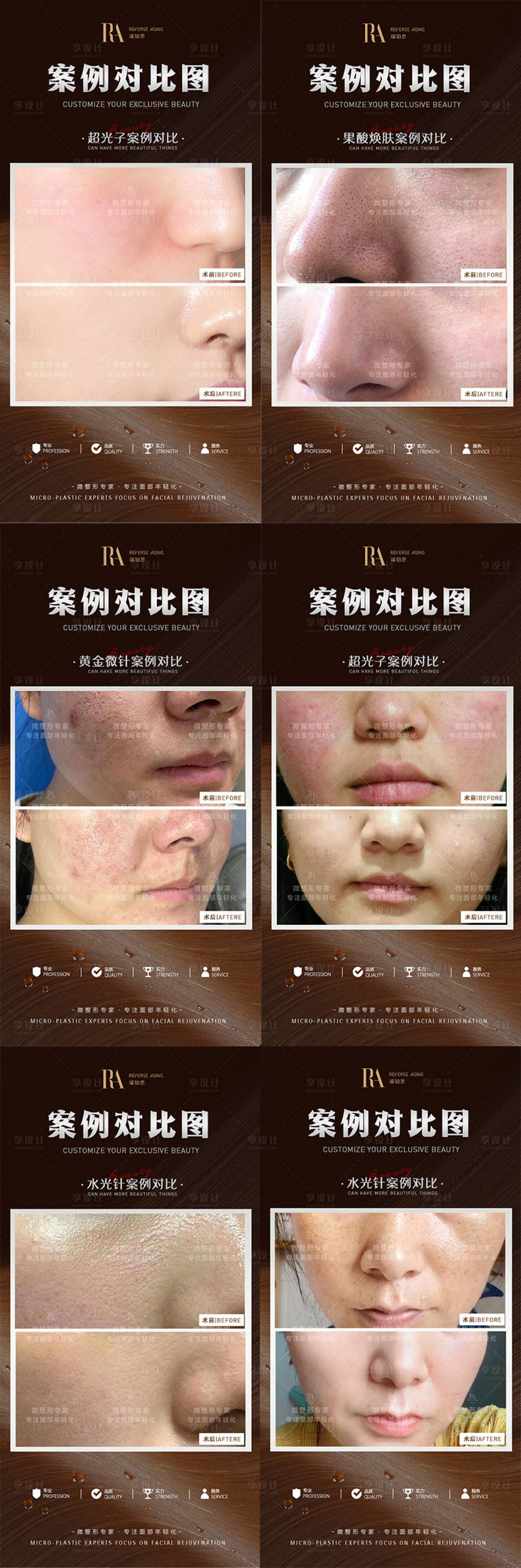 源文件下载【享设计】搜索编号：69440013397051052【医美皮肤项目案例10余款】