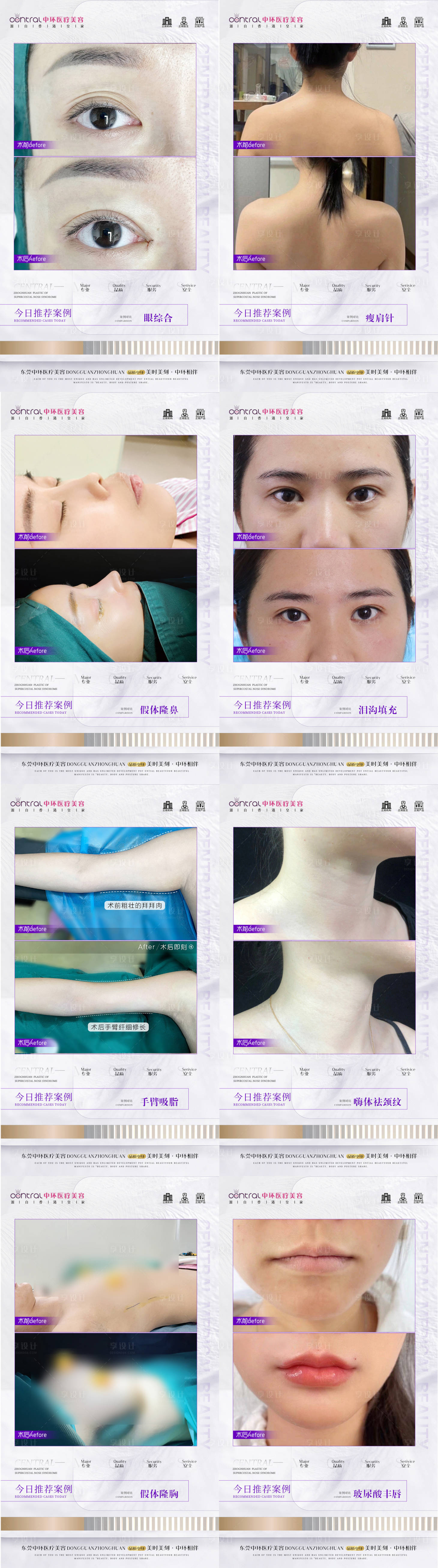 源文件下載【享設計】搜索編號：50270013420251873【醫美整形案例對比】
