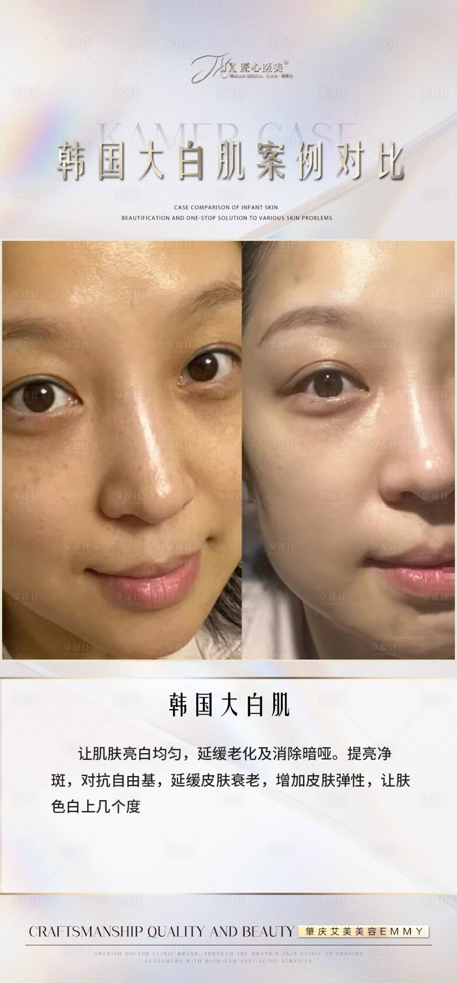 源文件下载【享设计】搜索编号：10780013220401103【医美案例对比海报】