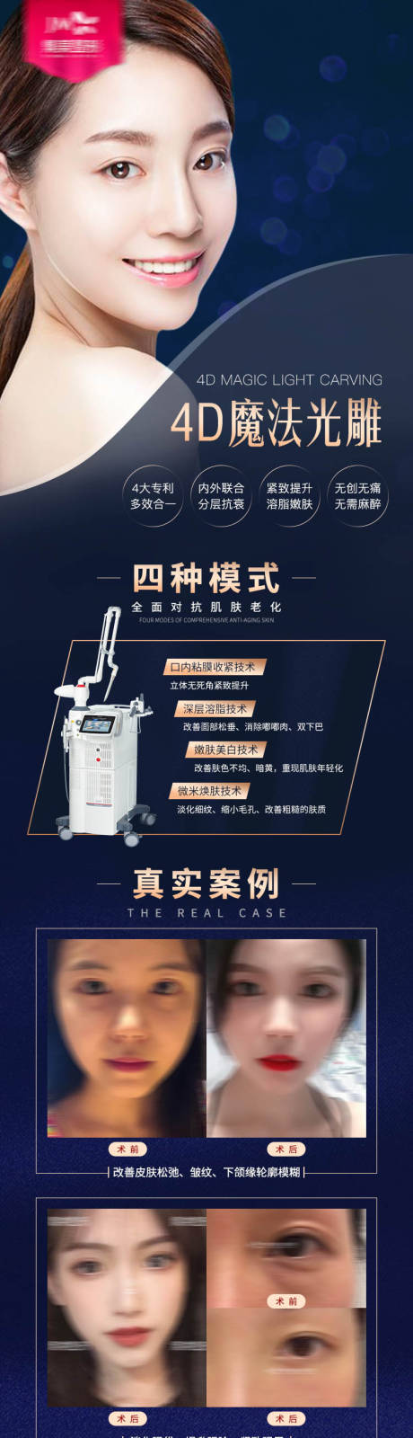 源文件下載【享設計】搜索編號：61610013208617539【醫美fotona4d案例長圖】