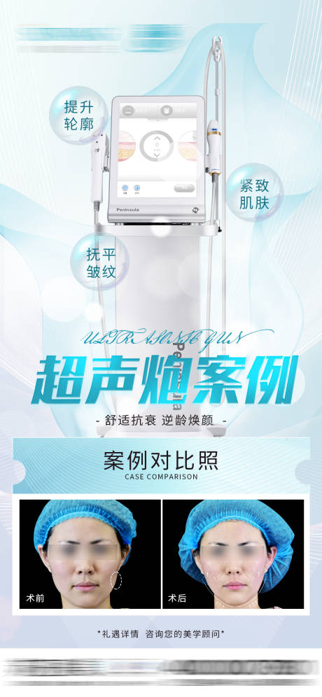 源文件下载【超声炮案例对比】编号：20221103124421730