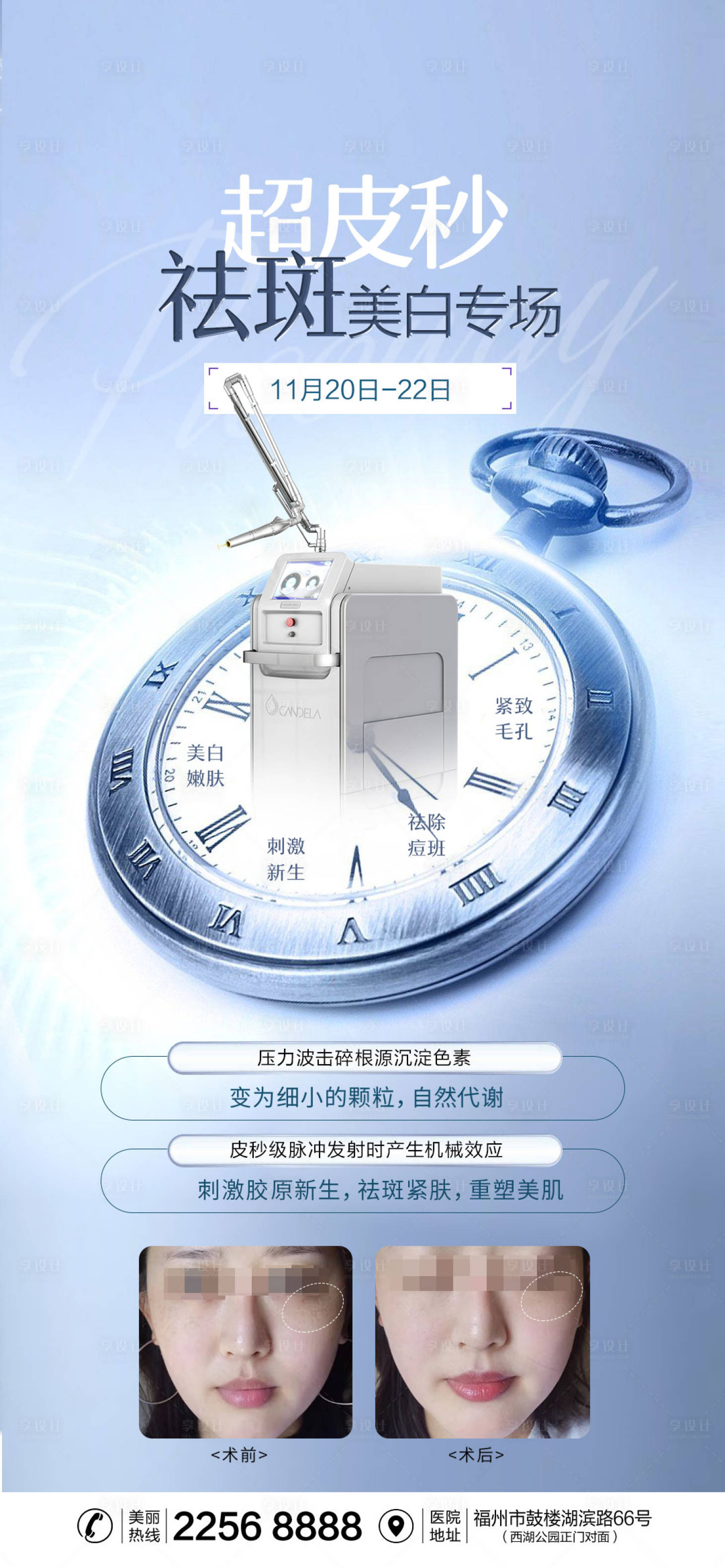 源文件下载【医美超皮秒祛斑海报】编号：52670013410397691
