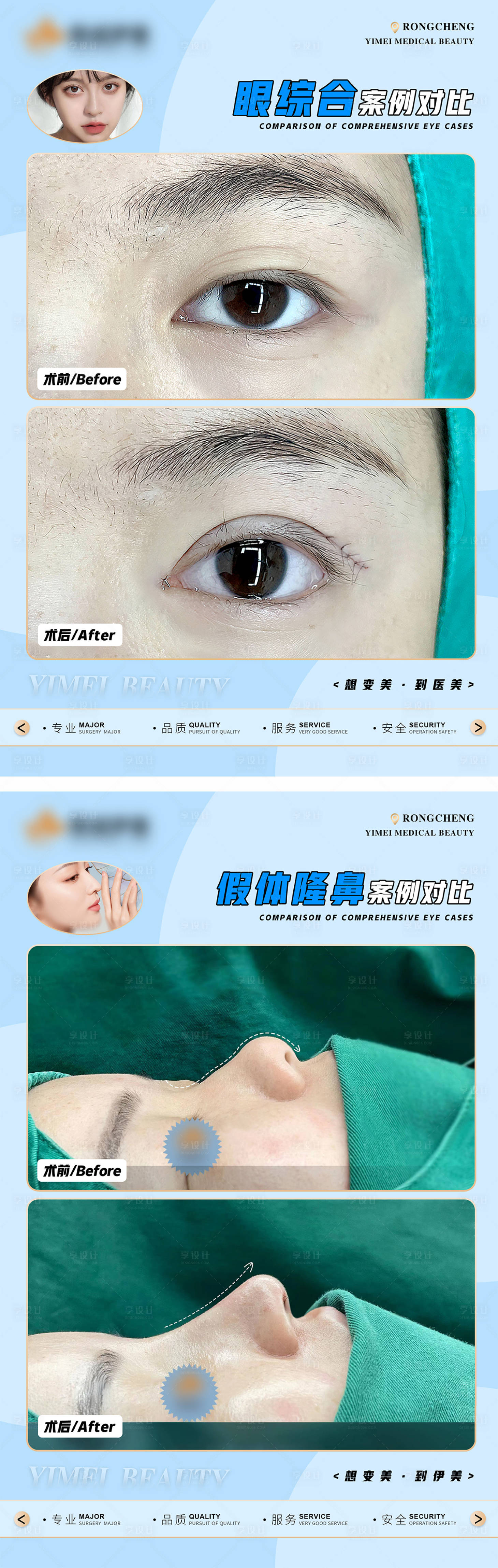 源文件下载【医美案例模板】编号：24740013345335709