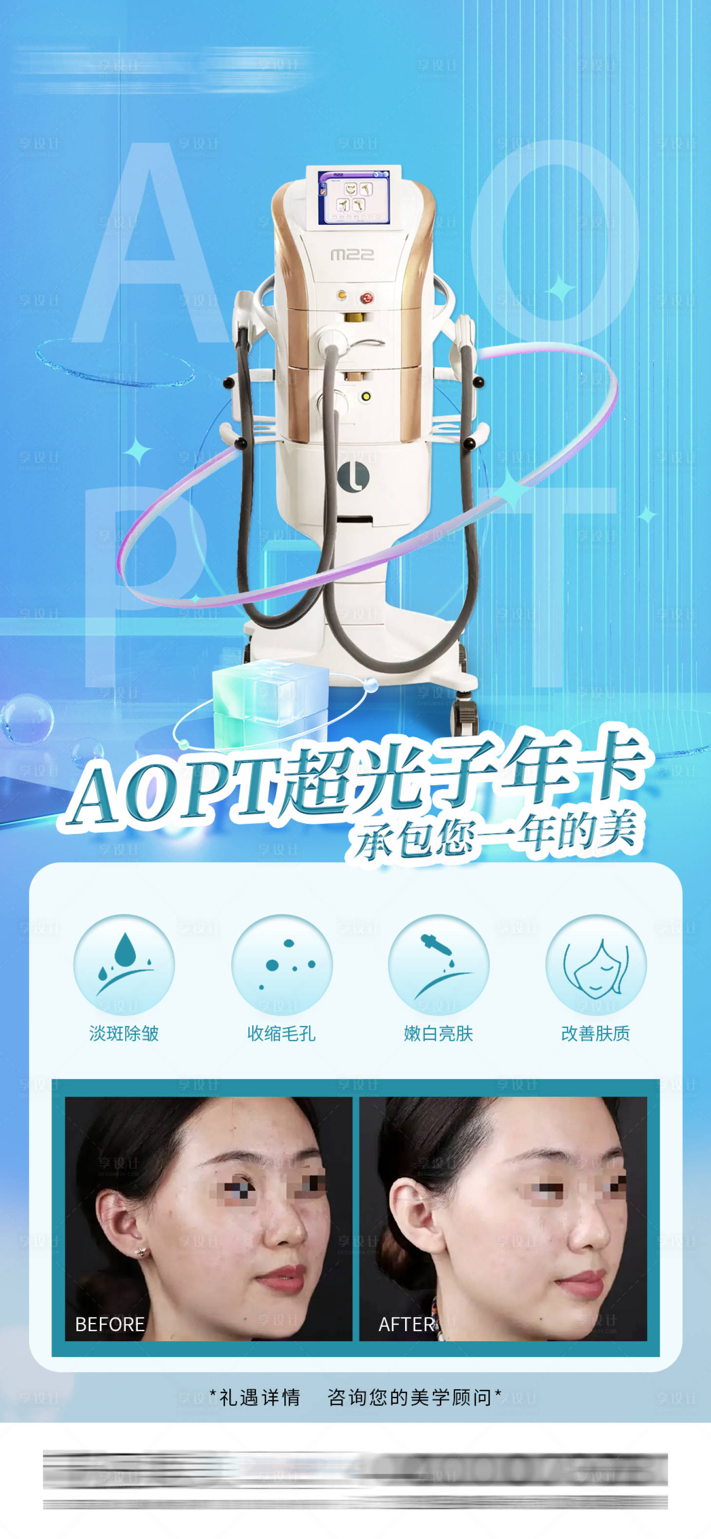 源文件下载【AOPT超光子案例对比照海报】编号：98610013085514964