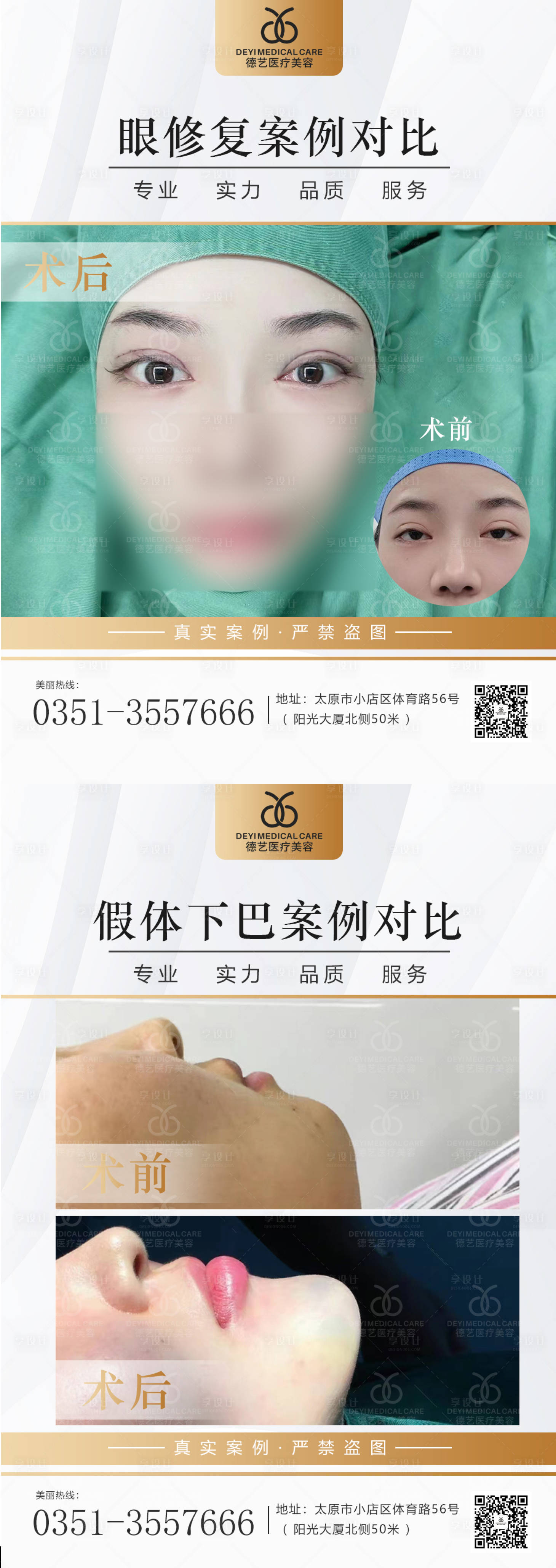 源文件下载【享设计】搜索编号：70620013363247432【医美案例对比图】