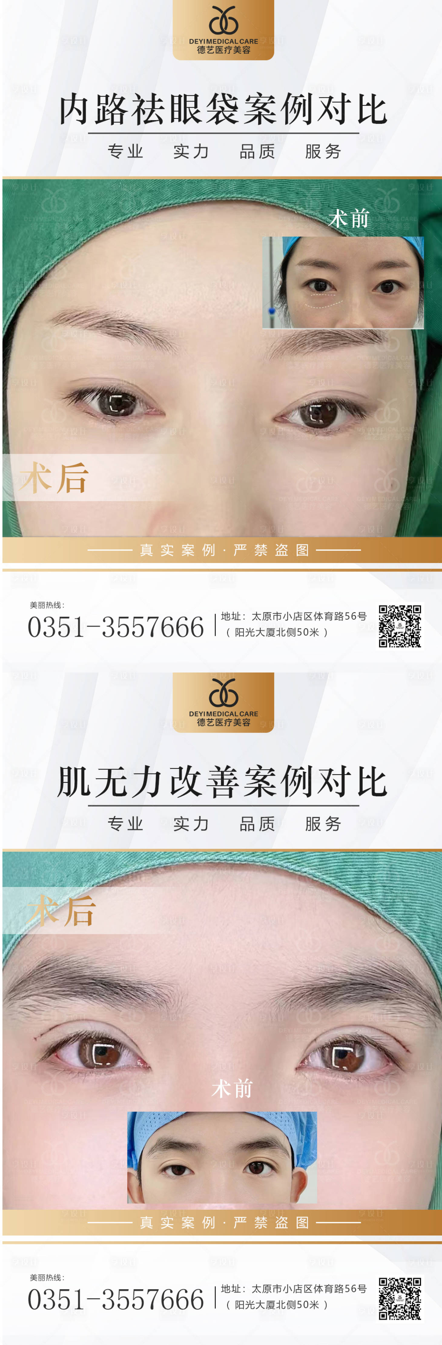 源文件下载【享设计】搜索编号：61560013107433915【医美案例对比图】