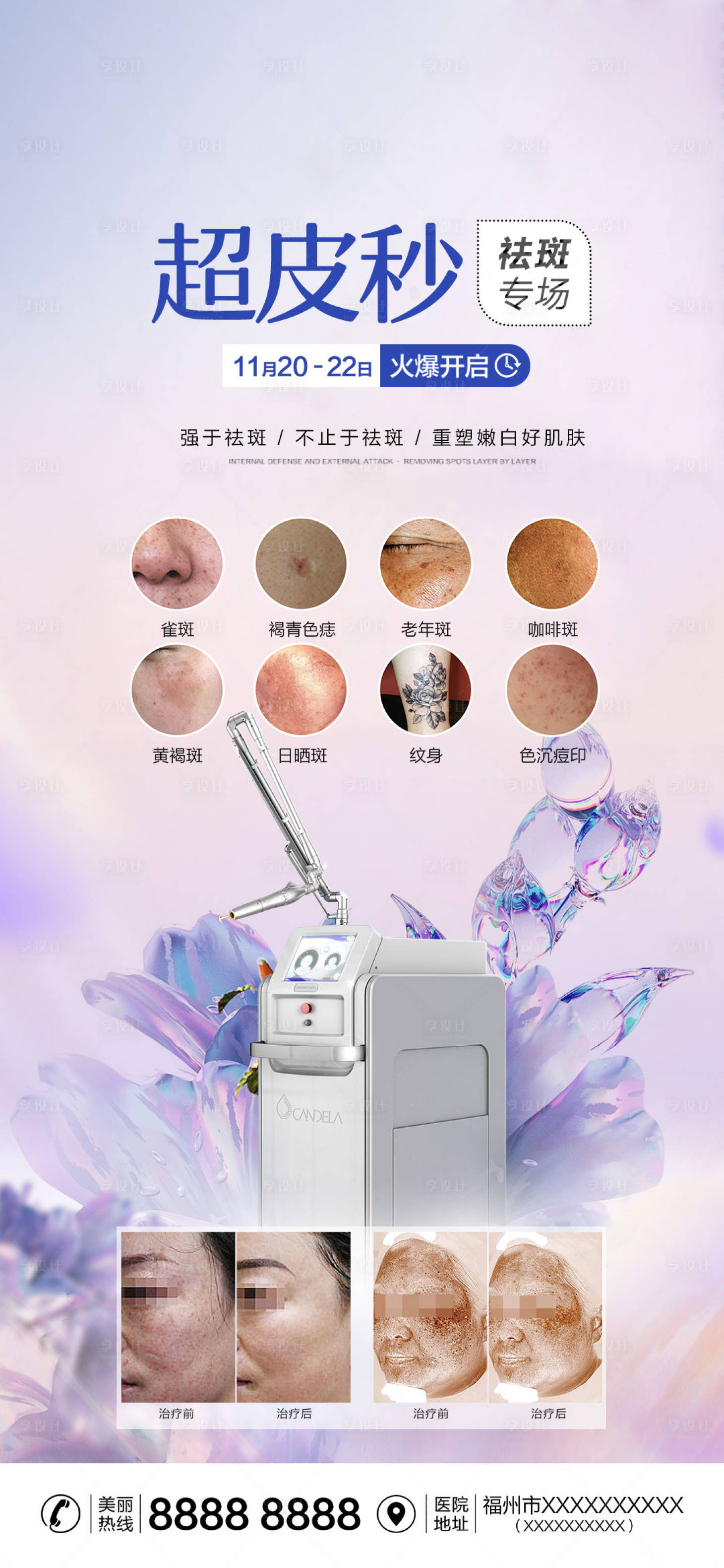源文件下載【享設(shè)計(jì)】搜索編號：98780013407231741【醫(yī)美超皮秒祛斑海報(bào)】