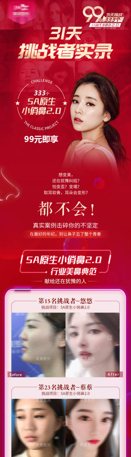 源文件下载【医美隆鼻案例长图】编号：68730013210008009