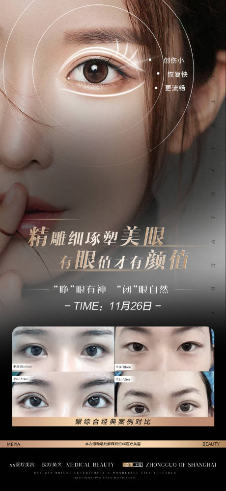 源文件下载【眼部专场】编号：26570013432528278